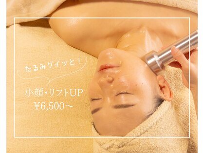 リセル(Recell)の写真