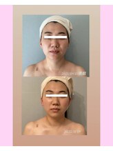 ソラ 高宮店(SORA)/ブライダルコルギセラピー