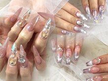 エムネイル(M-Nail)
