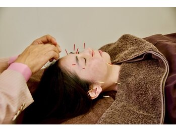 ビューティーパンク 黒田鍼治療院(Beauty Punc)の写真/働く女性に寄り添う30年の実績。熊本で最初の美容鍼としっかりとしたカウンセリングで美を整えるケア☆