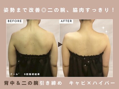 エステティックサロン アールグレーの写真