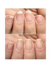 マリーロール 梅田店(Marie Laure)/自爪育成/深爪矯正/ネイルケア