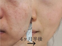 リリアンボーテ(LILIAN BEAUTE)
