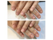 リアン(lien)