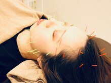 クマノミ美容鍼灸 浦和コルソ院(KUMANOMI美容鍼灸)/眼精疲労や自律神経の整えにも◎