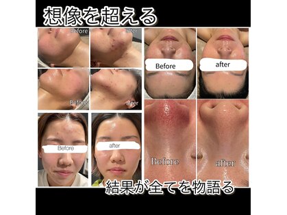インチャント(enchant)の写真