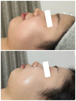 ビジュープラス 幸手店(Bijou+)/美白・シミケア