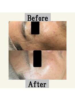 ペールノエル 三島店/VOSサロンケア(40代男性)