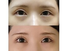 ノエルブラン(Noel blan)/