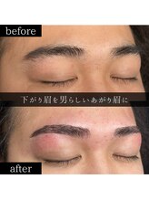 ユー 千葉駅前店(you)/ビフォーアフター写真