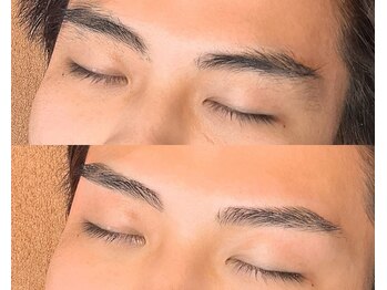 リリー(Lily)/【WAX脱毛】