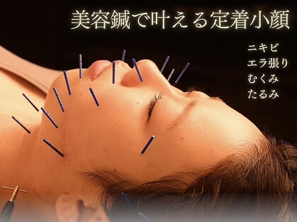 上本町カラダリセット【鍼灸整体/美容鍼/骨盤矯正】の写真