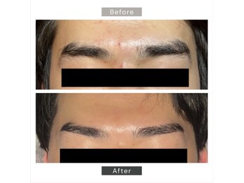 シーボウ(CBOU)/美容電気脱毛(眉毛)