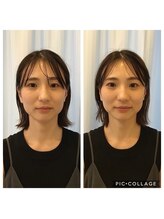 ビュースタイル川西/小顔矯正