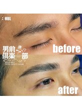 男前倶楽部/脱毛/メンズ脱毛/メンズ専門店