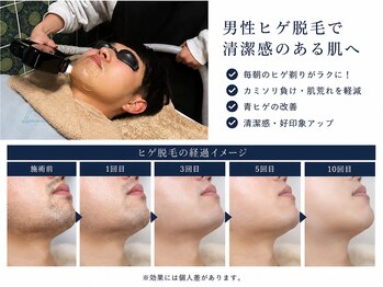 レガロ(REGARO)の写真/初めての方も経験者も◎メンズヒゲ脱毛￥2,000~！