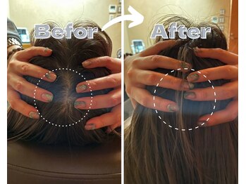 イザナイ(IZANAI)/Befor・After