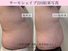 ラエッセ(La Esse)/メンズのぽっこりお腹も効果有！