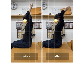 ナオル整体 飯田橋院(NAORU整体)/Before After/飯田橋/整体・矯正