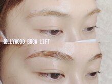 ウオン(UON)/ハリウッドブロウリフト