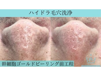 リメイククリニカルビューティー(Remake clinical beauty)/メンズのたしなみ