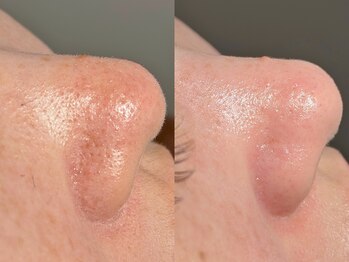 ルーナジェーナ(Luna llena)/池袋 エステ ルーナジェーナ