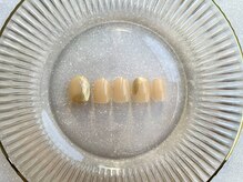 グリー 川口駅前店(glee)/【Hand】simple コース￥6,800