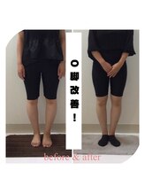 スタイルラボ高松/O脚矯正の効果♪