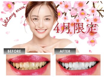 エクシアホワイトニング 天王寺店