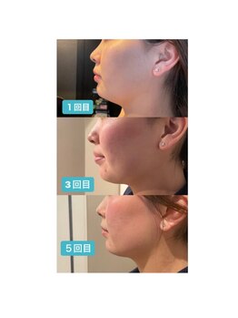 アディクト(Addict)/Before＆After