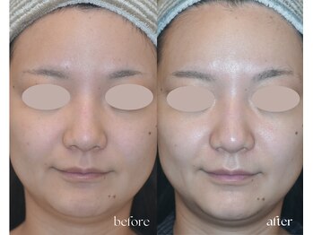 岩川治療院/赤み乾燥肌から引き締まりツヤ肌