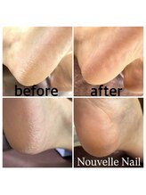 ヌーベルネイル(Nouvelle Nail)/足裏角質ケア