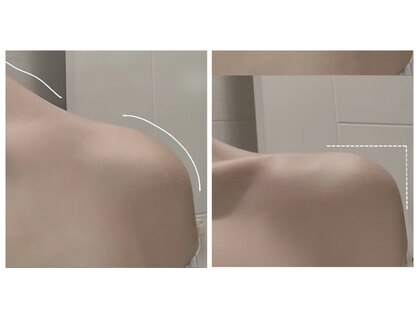 サナ(Sana)の写真