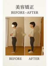 ブリリアントスマイル/猫背や反り腰解消