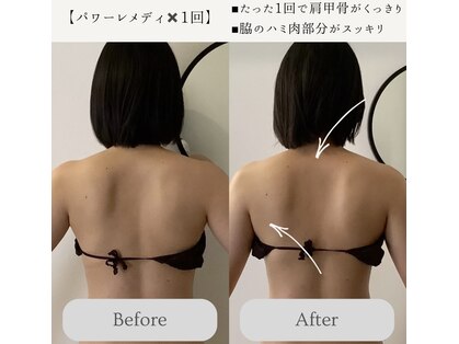 エミィ(emmy)の写真