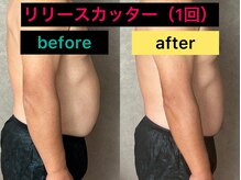 シュシュ(chouchou)/リリースカッターむくみスッキリ