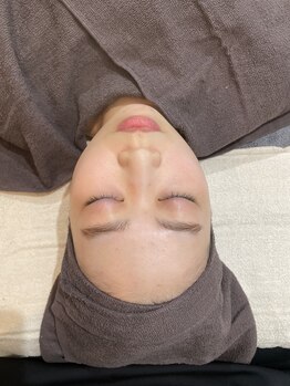 ミラ(Mira)/ハーブピーリング