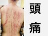 【頭も辛い方】台湾式カッサ×筋膜アプローチ（頭皮/首/肩/背中/腰）