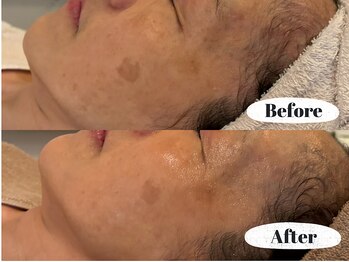 シーン(Sheen)/シミケアに白玉美白。