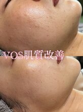 ティアーナ(Tiaana)/肌質改善VOSサロンケア