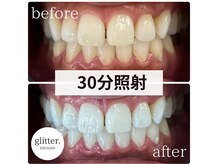 グリッター ショウナン(glitter.SHONAN)の雰囲気（【結果重視】歯を本気で白くしたい方大歓迎!!）