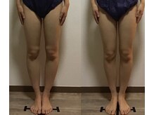 Ms.やまとなでしこ 明石店/全身リフトアップO脚改善