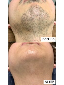 バディーズ(BUDDieS)/20代