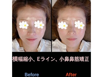 美容矯正サロン レレポノ(LELEPONO)/