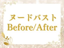 エクラパピヨン 荻窪(Eclatpapillon)/ヌード＊バストアップ＊施術例