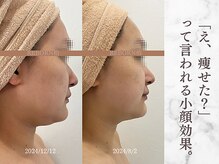 リボーン 柏(REBORN)/柏で人気の“顔印象アップ”ケア