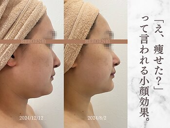 リボーン 柏(REBORN)/柏で人気の“顔印象アップ”ケア