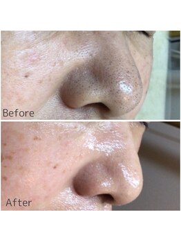 メープルサロン(MAPLE SALON)/頑固な毛詰まりが解消！