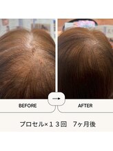 七や美肌/70歳約半年でここまでの変化