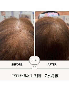 七や美肌/70歳約半年でここまでの変化